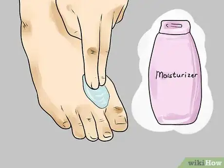 Image intitulée Use Apple Cider Vinegar for Athlete's Foot Step 7