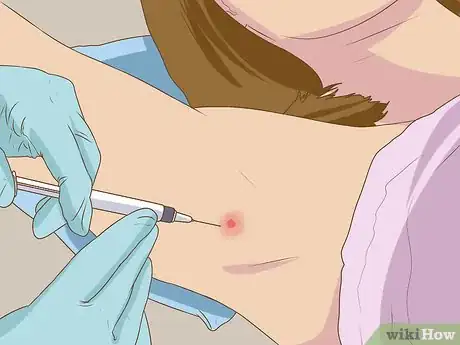 Image intitulée Get Rid of a Zit on Your Armpit Step 15