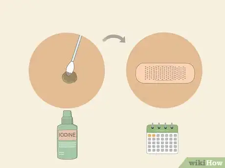 Image intitulée Get Rid of Warts Step 18