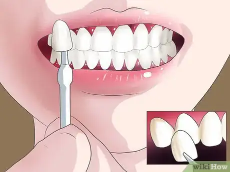 Image intitulée Bleach Your Teeth Step 7