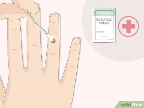 Image intitulée Get Rid of Warts Step 10