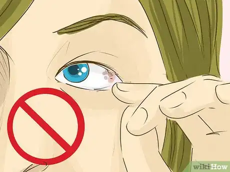 Image intitulée Remove Something from Your Eye Step 11