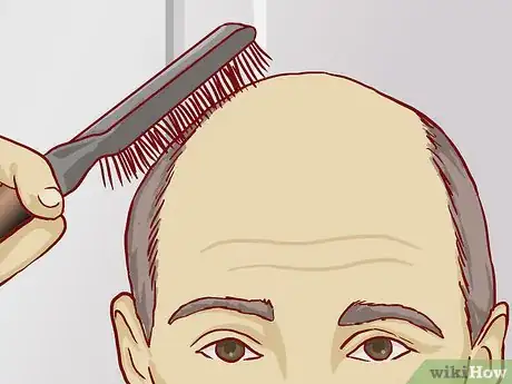 Image intitulée Know if You Have Male Pattern Baldness Step 1