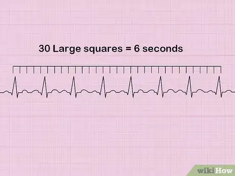 Image intitulée Calculate Heart Rate from ECG Step 5