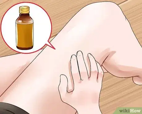 Image intitulée Get Rid of Ringworm Naturally Step 1