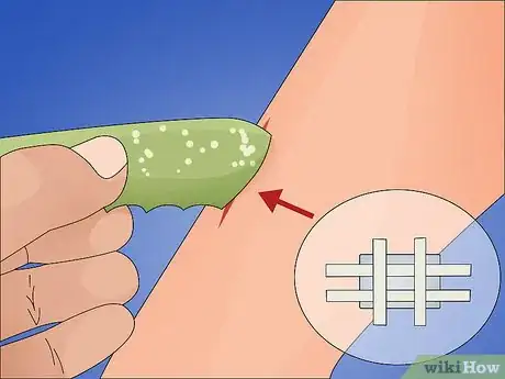 Image intitulée Make a Quick Disinfectant for Minor Cuts and Abrasions Step 10