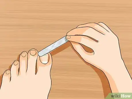 Image intitulée Get Rid of Yellow Toenails Step 15