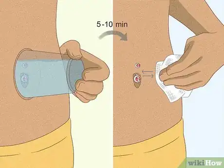Image intitulée Pierce Your Belly Button Step 14