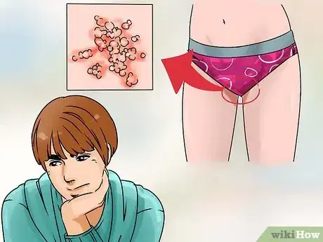 Image intitulée Have Sex with Someone with Herpes Step 1