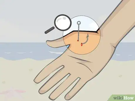 Image intitulée Pull a Fish Hook from Your Finger Step 10