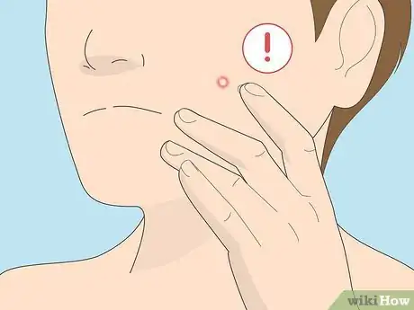 Image intitulée Get Rid of a Pimple Using Toothpaste Step 6