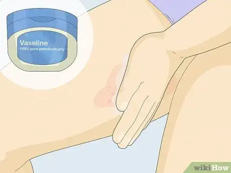 Image intitulée Prevent Chafing Step 10