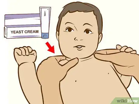 Image intitulée Treat Neck Rashes for Your Baby Step 5