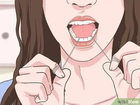 Image intitulée Prevent Tonsil Stones Step 2