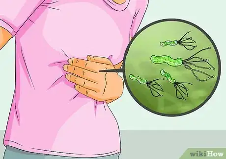 Image intitulée Cure H. Pylori Naturally Step 17