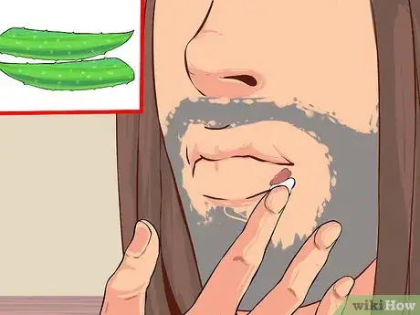 Image intitulée Grow and Use Aloe Vera for Medicinal Purposes Step 10