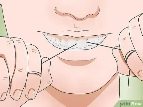 Image intitulée Reduce Gum Swelling Step 3