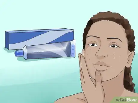 Image intitulée Use Household Pantry and Bathroom Items to Remove Acne Step 4