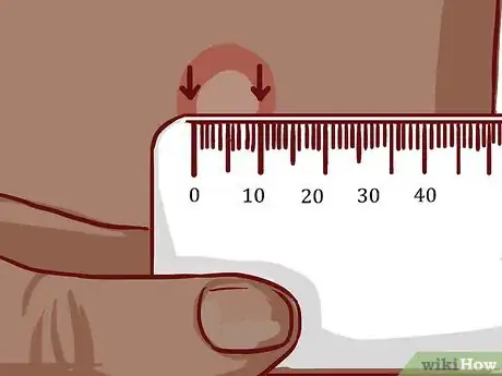 Image intitulée Read a Tuberculosis Skin Test Step 6