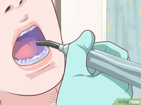 Image intitulée Treat Periodontal Disease Step 13