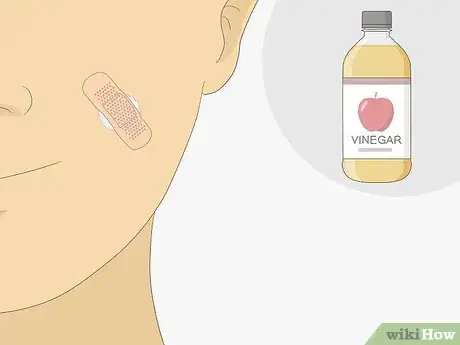 Image intitulée Get Rid of Warts Step 31