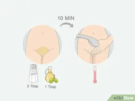 Image intitulée Get Rid of Ingrown Pubic Hair Step 7