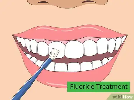 Image intitulée Treat Cavities Step 3