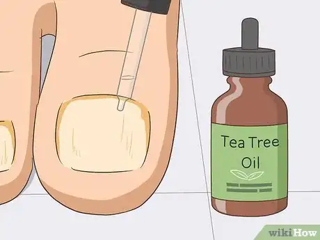 Image intitulée Hide Nail Fungus Step 15