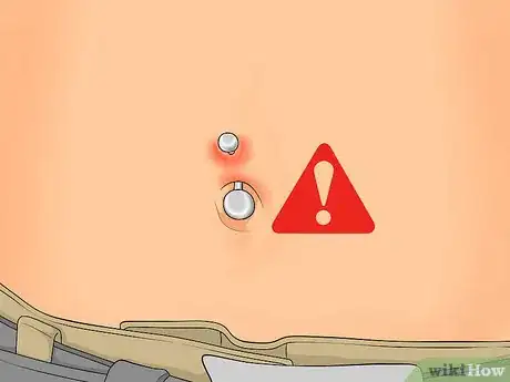 Image intitulée Treat an Irritated Belly Button Piercing Step 10