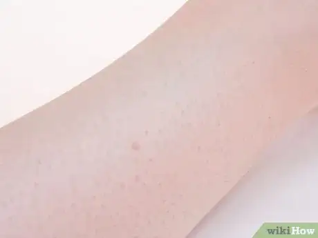 Image intitulée Prevent Ingrown Hairs on Your Legs Step 14