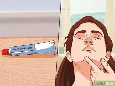 Image intitulée Get Rid of Ingrown Hair Scars Step 6
