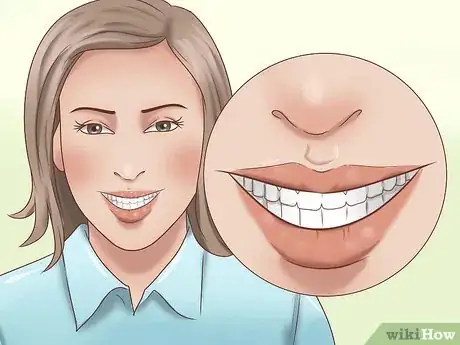 Image intitulée Have the Perfect Smile Step 5