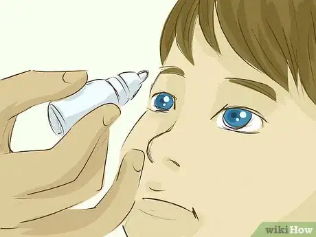 Image intitulée Use Eye Drops Step 26