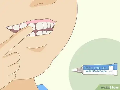 Image intitulée Pull Out a Tooth Without Pain Step 5