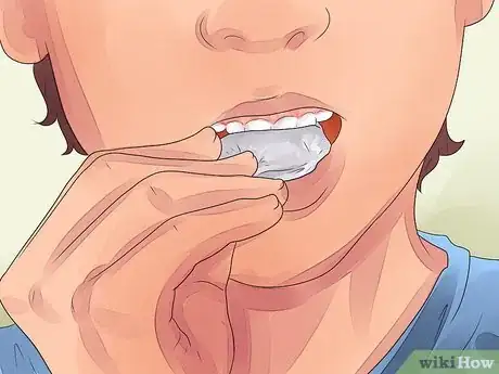 Image intitulée Make a Loose Tooth Fall Out Without Pulling It Step 9