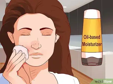 Image intitulée Clear Up Rosacea Without Medication Step 8