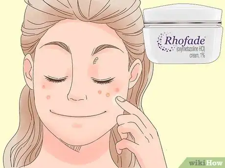 Image intitulée Remove the Redness of a Pimple Step 11