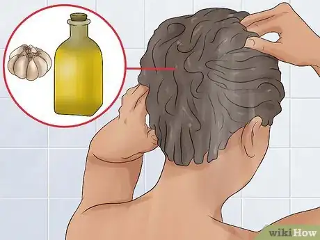 Image intitulée Use Garlic As a Hair Loss Remedy Step 8