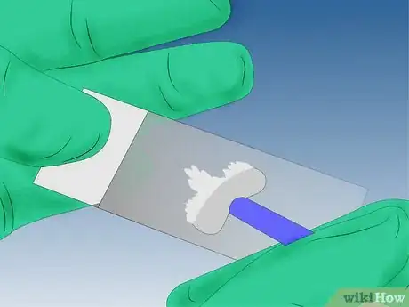 Image intitulée Do a Pap Smear Step 10