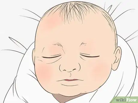 Image intitulée Know What to Expect on a Newborn's Skin Step 4