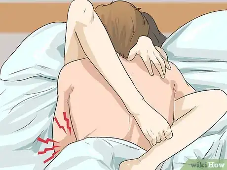 Image intitulée Treat PID (Pelvic Inflammatory Disease) Step 1