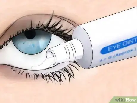 Image intitulée Treat Dry Eyes Step 5