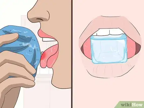 Image intitulée Reduce Tongue Swelling Step 10