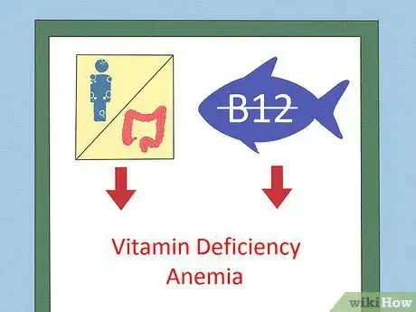 Image intitulée Know if You Are Anemic Step 7