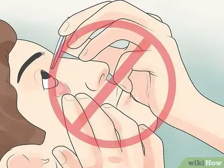 Image intitulée Remove Foreign Objects from the Eye Step 5