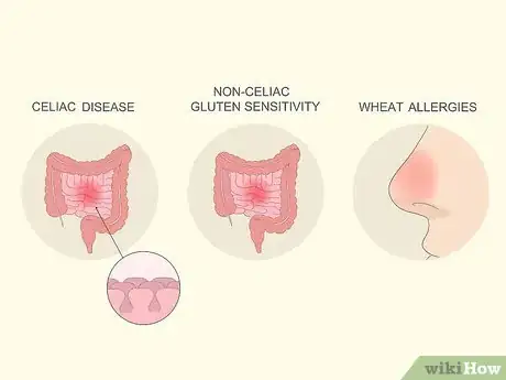 Image intitulée Test for Gluten Intolerance Step 2