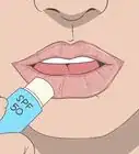traiter les brulures sur les lèvres