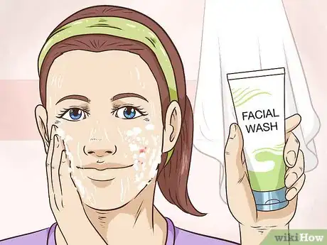 Image intitulée Painlessly Pop a Pimple Step 13