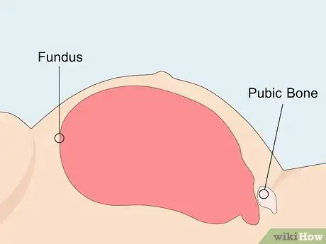 Image intitulée Measure Fundal Height Step 13