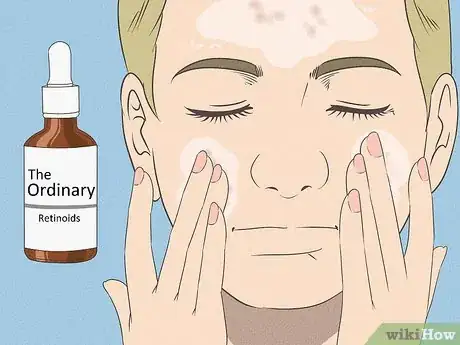 Image intitulée Get Rid of Acne if You Have Fair Skin Step 5
